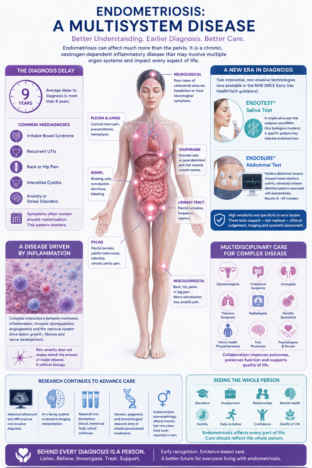 Informational poster about endometriosis, showing a human body with highlighted affected areas, symptoms, diagnosis delay, and multidisciplinary care options.