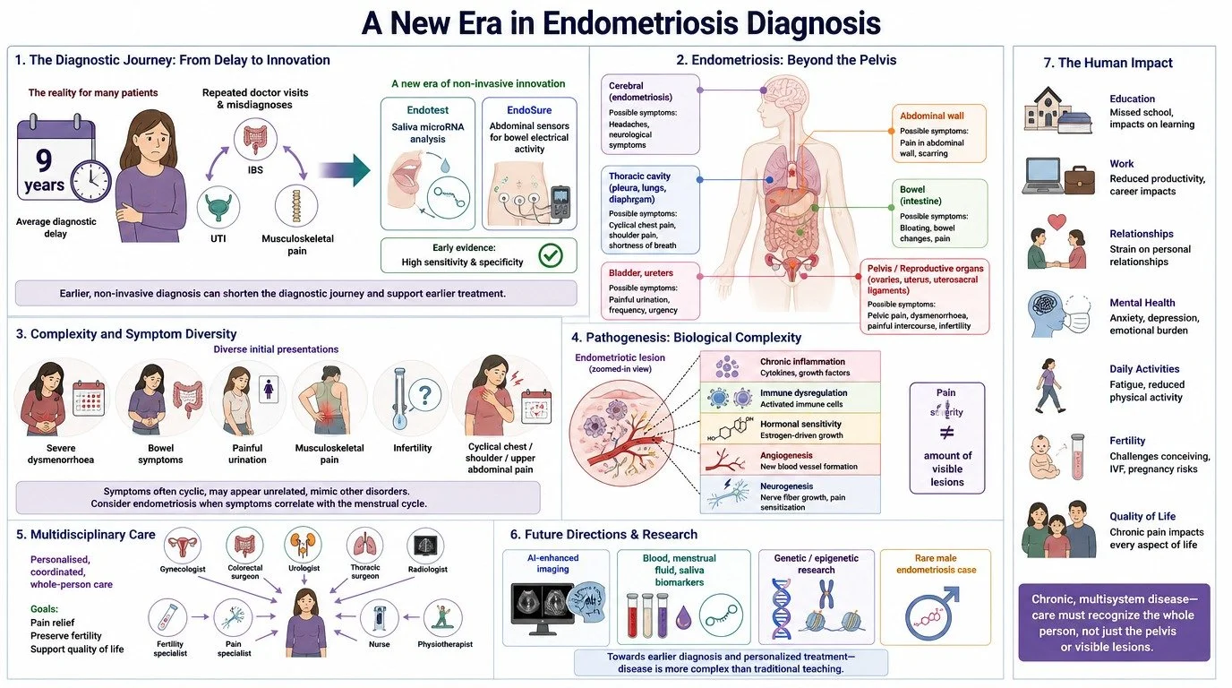 A comprehensive infographic titled 'A New Era in Endometriosis Diagnosis' outlining the diagnostic journey, beyond the pelvis, human impact, symptom diversity, biological complexity, multidisciplinary care, and future research directions in endometri