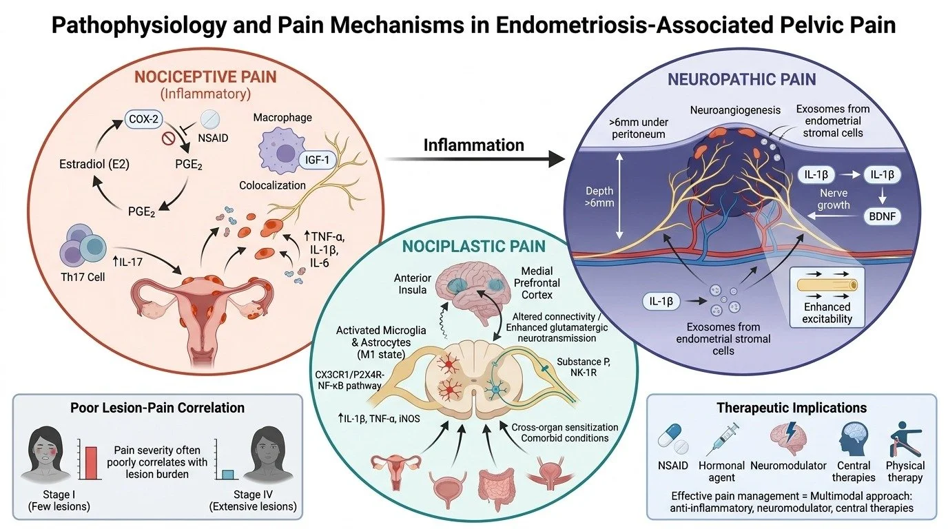 A detailed infographic illustrating the pathophysiology and pain mechanisms in endometriosis-associated pelvic pain. The diagram is divided into three main sections: Nociceptive Pain, Neuropathic Pain, and Nociplastic Pain, showing processes like inf