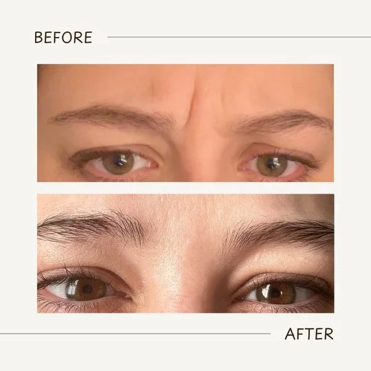 Medspa in Mentor, OH 44060 | Botox Near Me