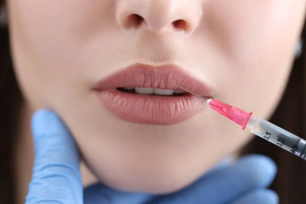 Close-up of a woman's lips receiving a cosmetic injection, with a syringe held by someone wearing blue gloves.