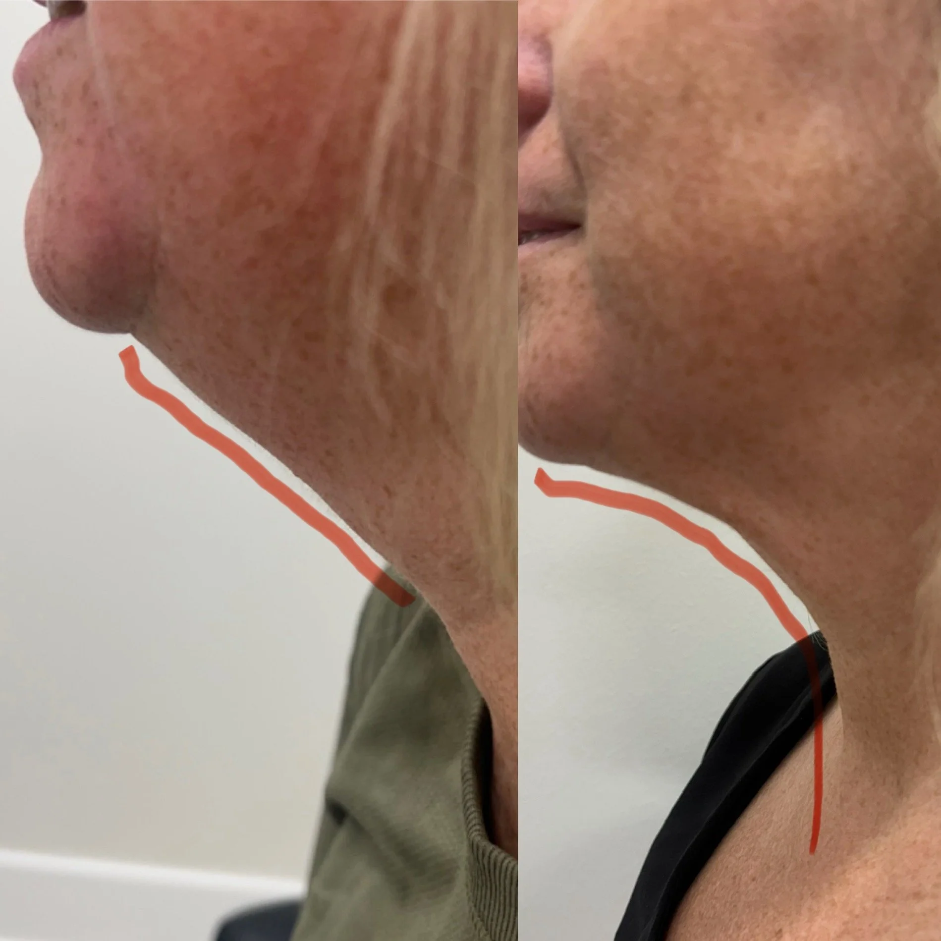 Medspa in Mentor, OH, 44060 | PDO Threads Near Me