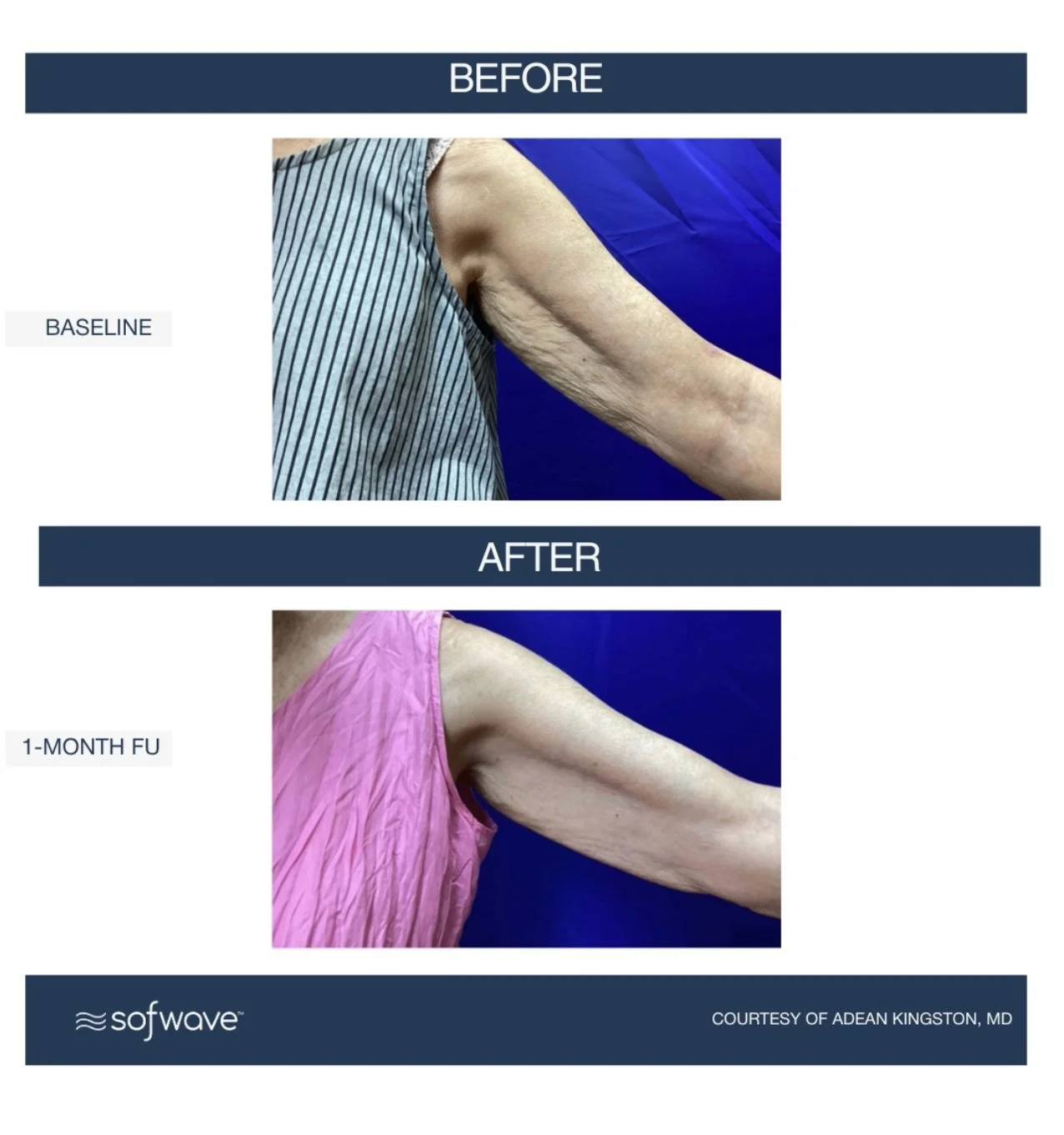 Medspa in Mentor, OH, 44060 | Sofwave Near Me