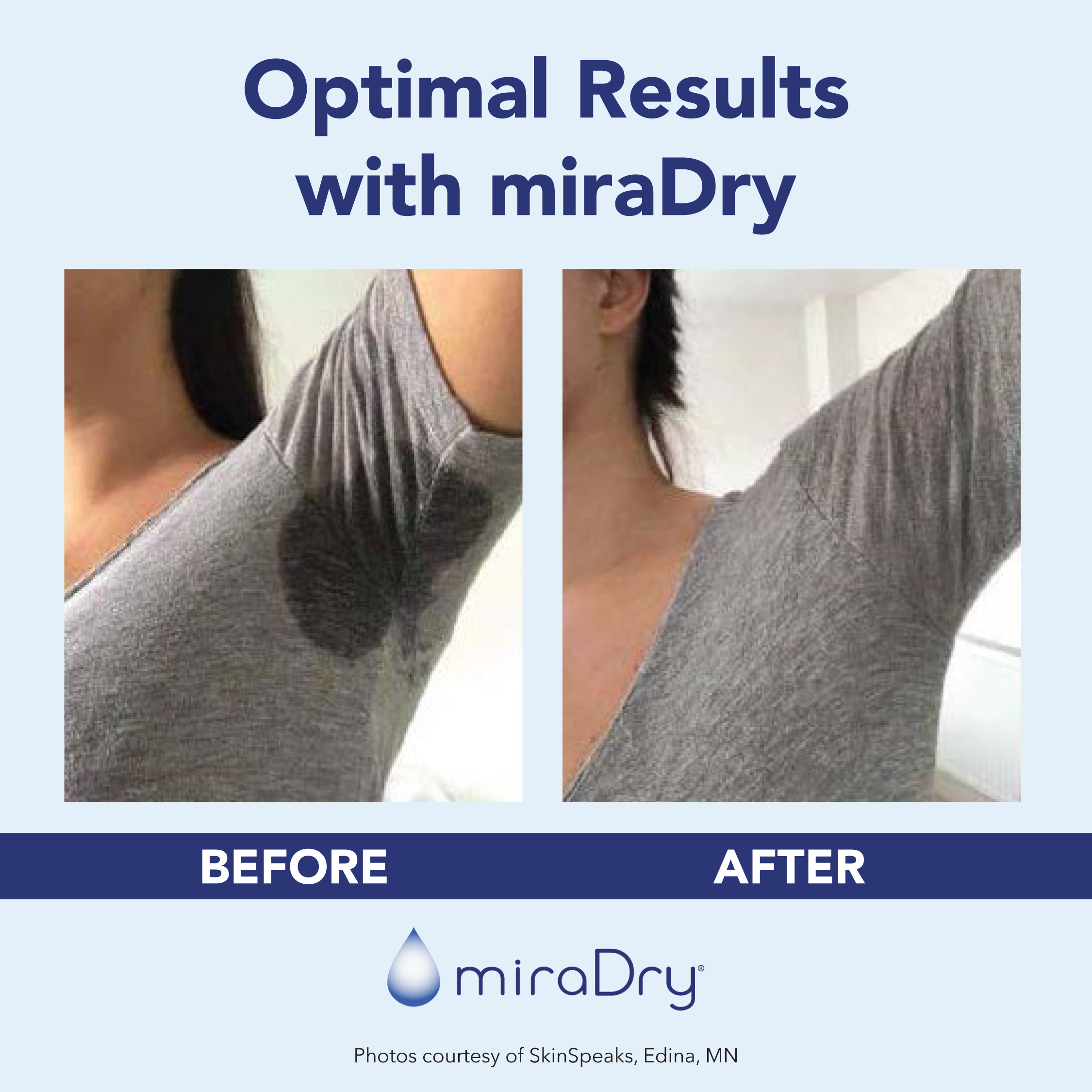 230518-mD-Before-After-IG-v2-01.webp