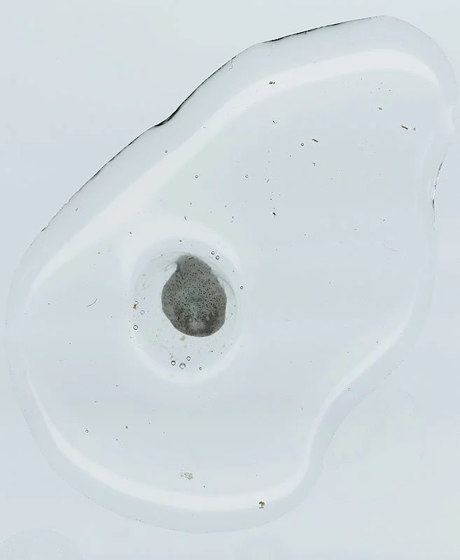 Spotted Salamander Egg, Ambystoma maculatum at 40 hour. 2000/01. Iris prints on Arches watercolor paper. Edition size of 3 plus one artist\'s proof and one printer\'s proof. 46 x 34 inches.