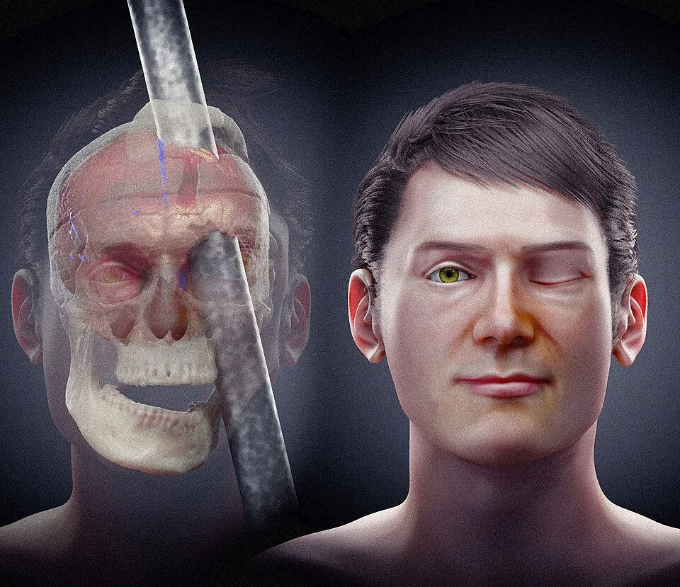 Phineas Gage