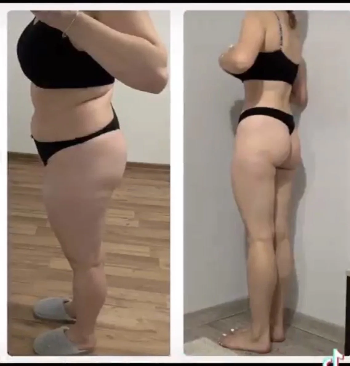 Side-by-side comparison of a woman before and after weight loss, showing her in black underwear in both images.