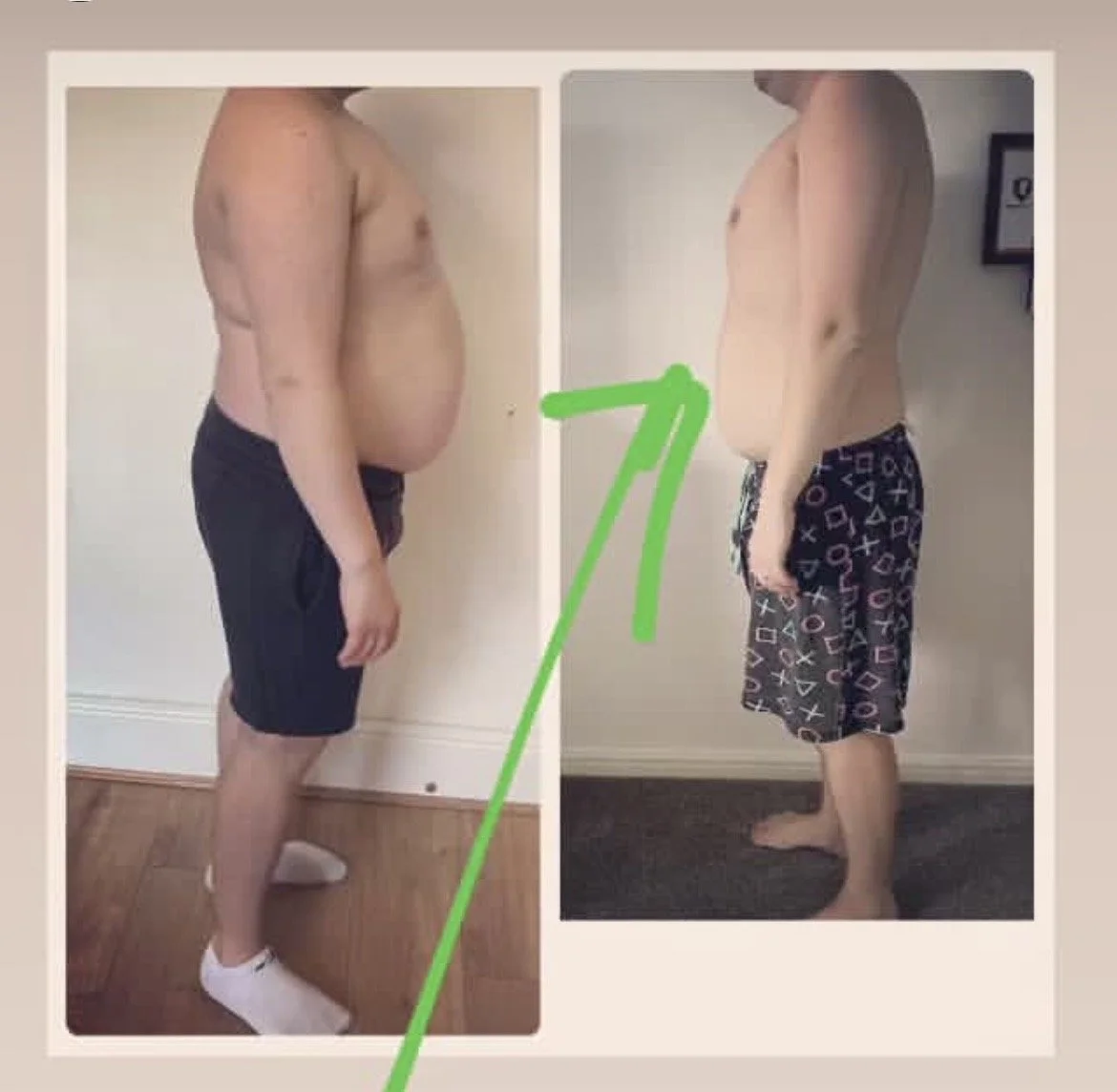 Side-by-side before and after photos of a man's weight loss progress, showing a reduction in body size and belly fat.
