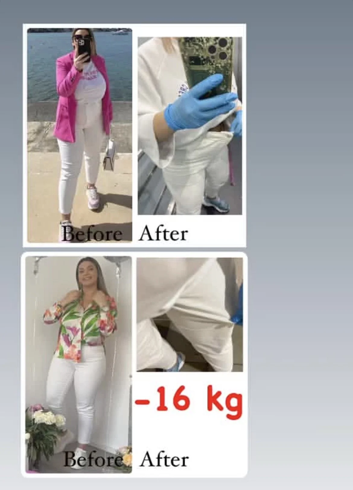 Comparison of before and after photos showing weight loss, with the woman in the before photos wearing colorful outfits and in the after photos showing a slimmer figure. The images also highlight the process of weight loss with photos of a person in 