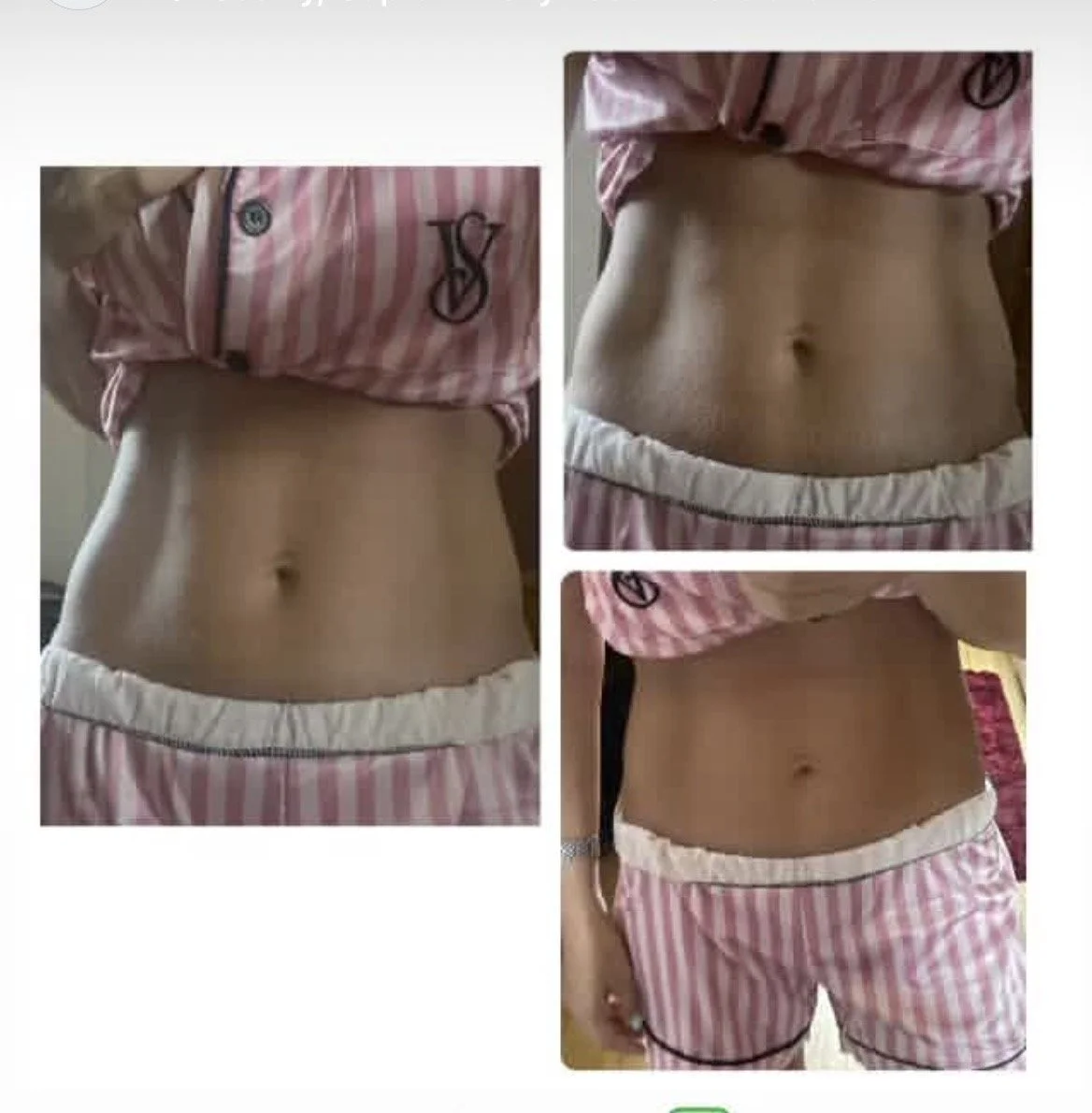 Three close-up photos of a woman's toned and flat stomach wearing pink and white striped pajama shorts and a matching top.
