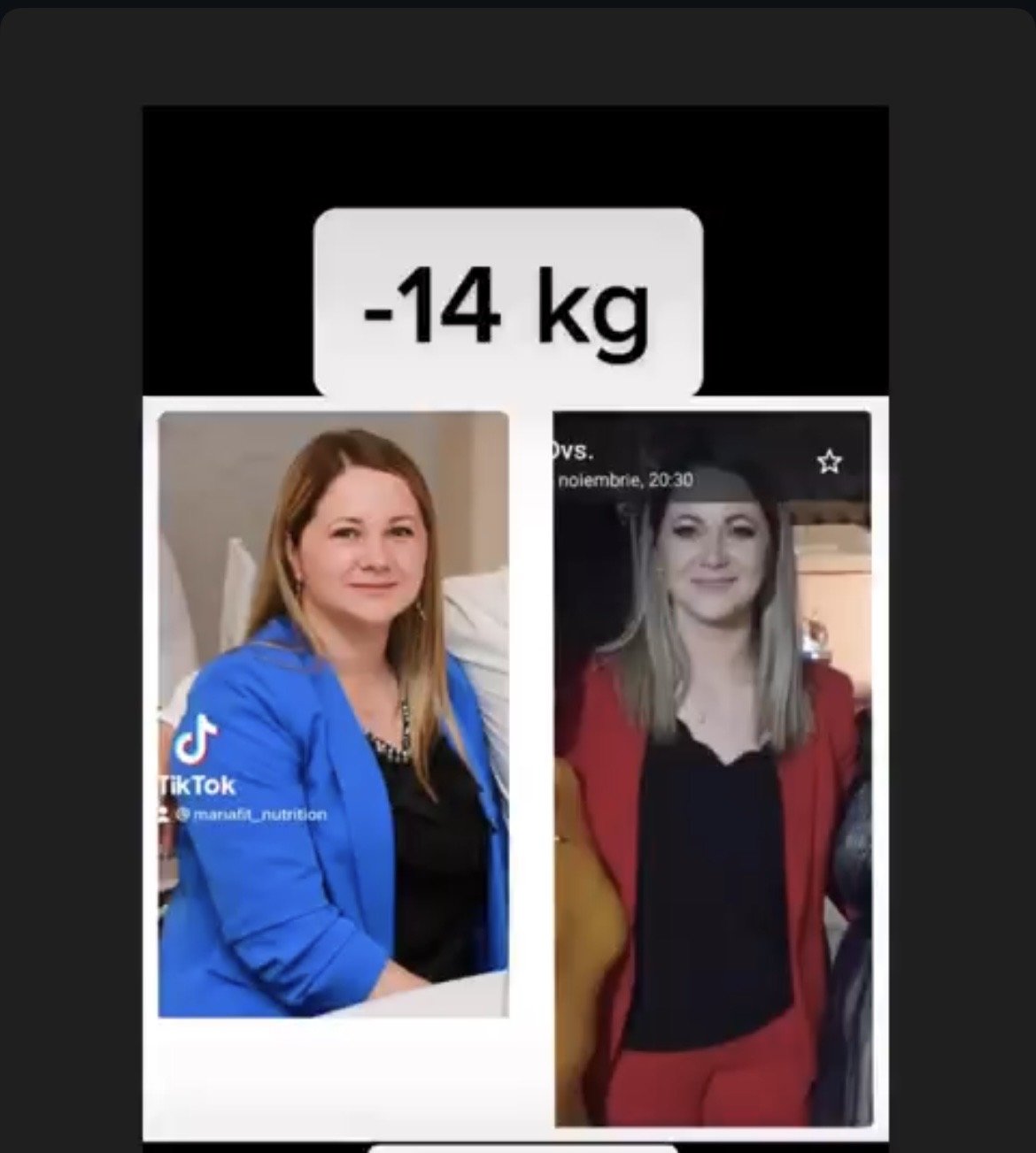 Before and after photos of a woman showing a weight loss of 14 kilograms.