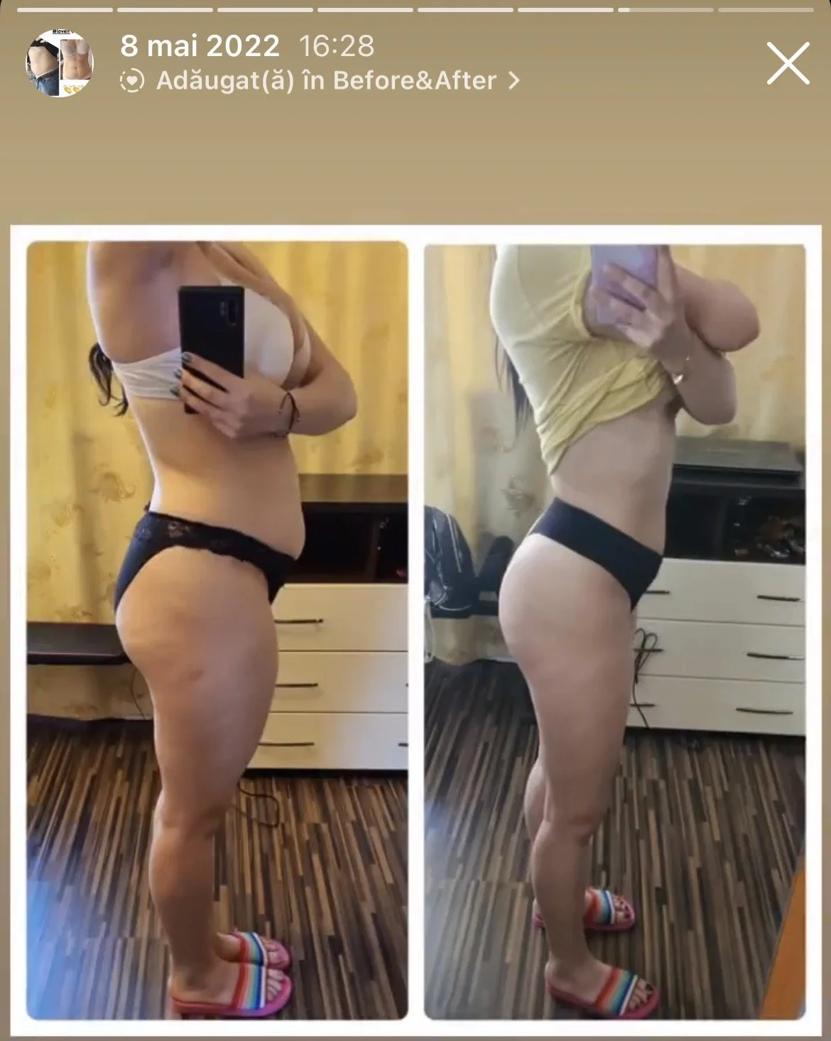 Before and after photos of a woman showing weight loss progress, taking mirror selfies in a room with yellow curtains, wearing a white top and black underwear, in the first image, and a yellow top with black underwear in the second image.