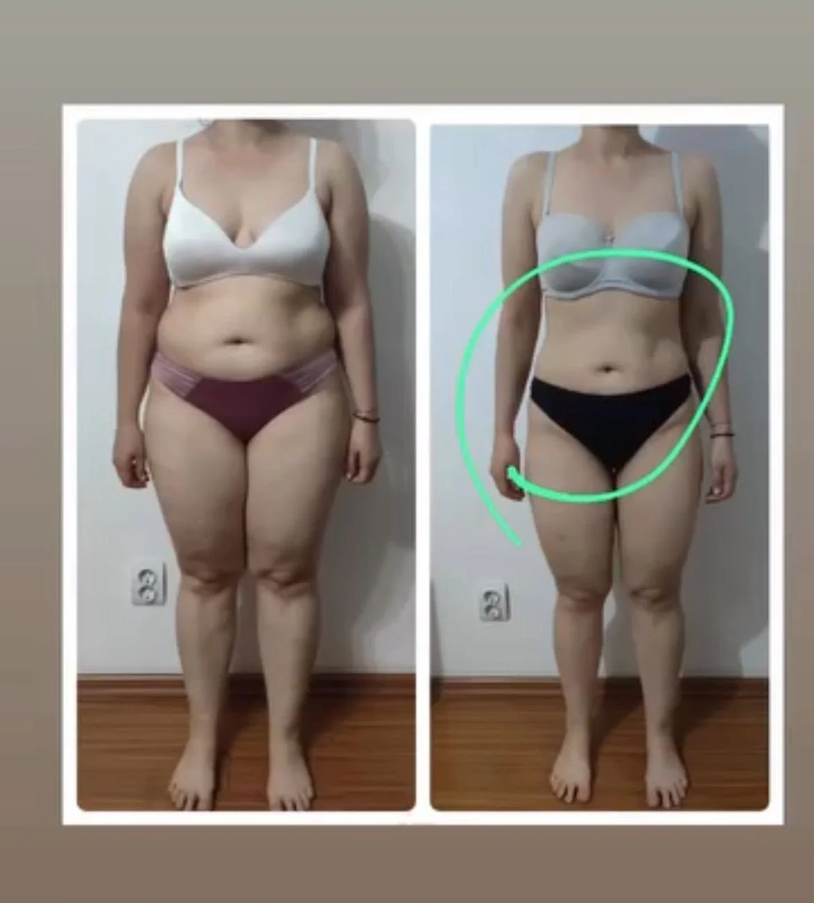 Side-by-side comparison of a woman before and after weight loss, with the after photo marked by a green circle.