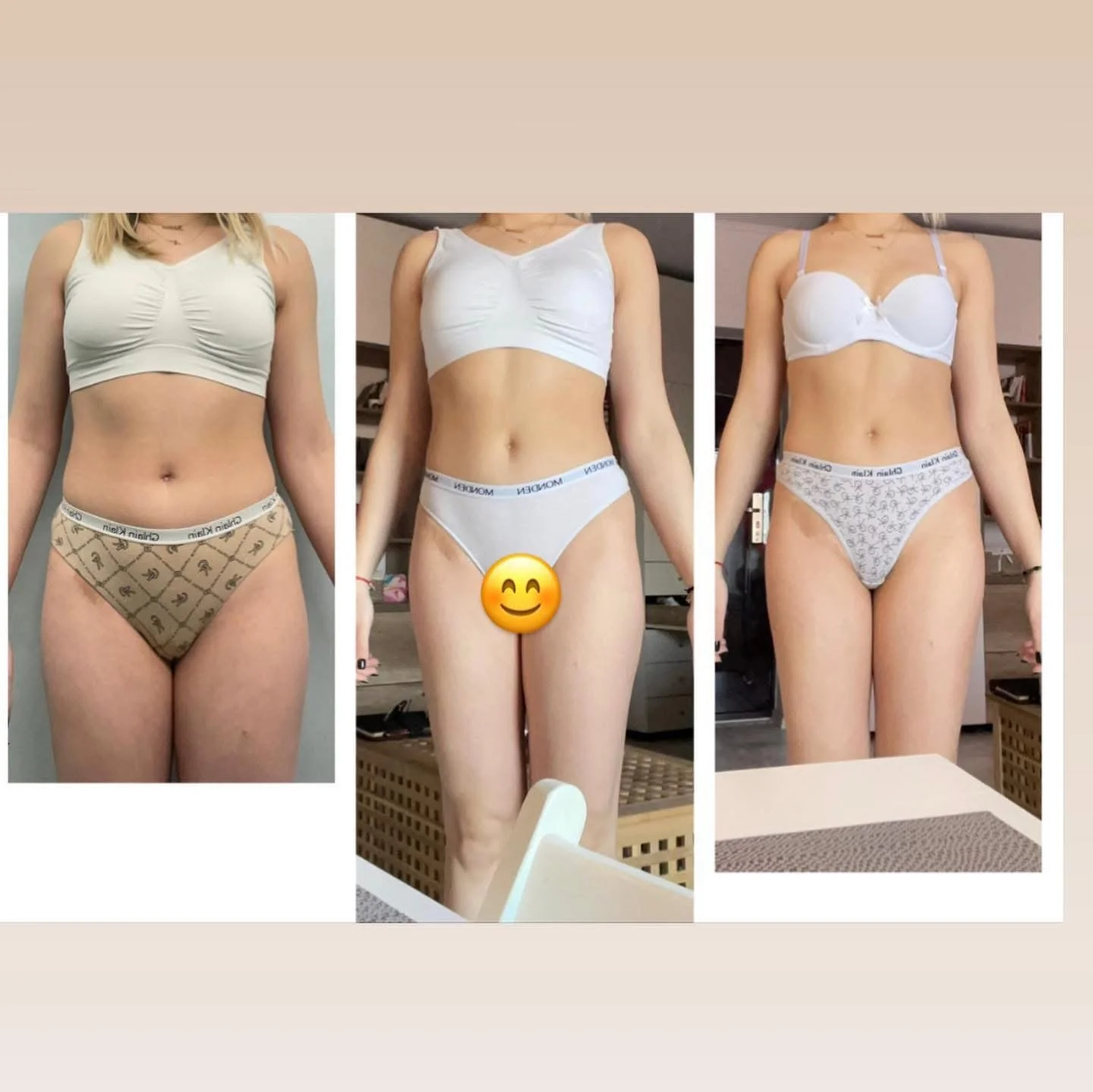 Triptych of a woman showing a progression of her body transformation, wearing white tops and underwear in each photo, with a smiley emoji overlay in the middle image.