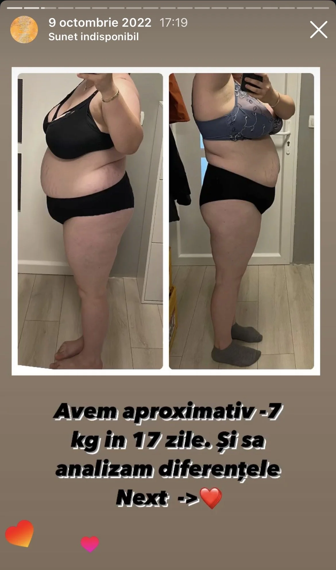 Side-by-side comparison of a woman's body before and after losing approximately 7 kg in 17 days, showing noticeable weight reduction and body transformation.
