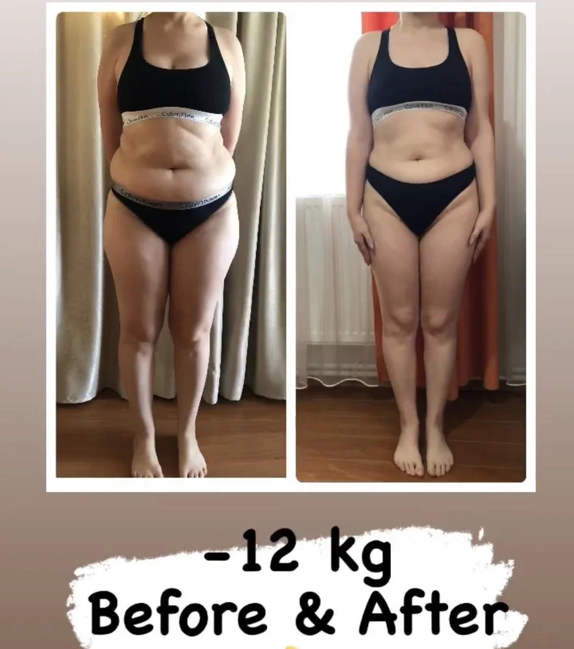 Side-by-side comparison of a woman before and after losing 12 kg, showing body transformation with weight loss, in underwear, standing against curtains and a radiator.