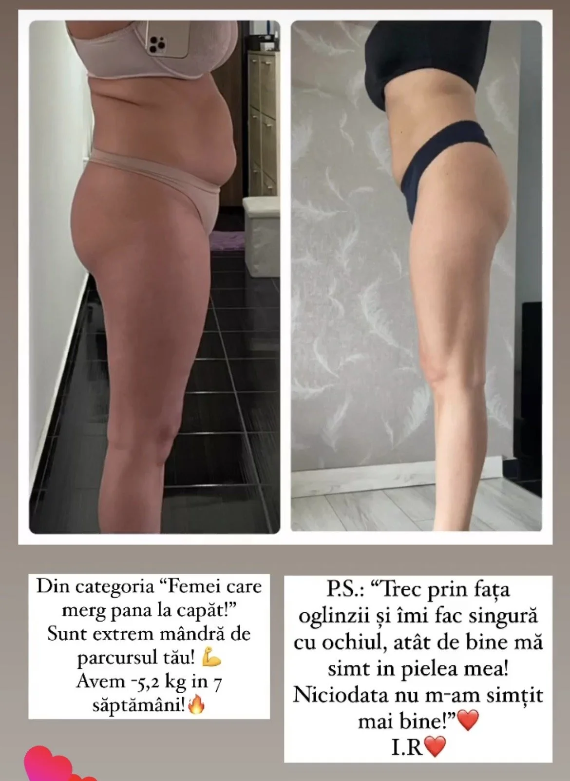 A side-by-side comparison of a woman's body before and after weight loss. The left side shows a woman with a larger abdomen and thighs, the right side shows a slimmer, toned leg and waist. Below the images are captions in Romanian about her weight lo