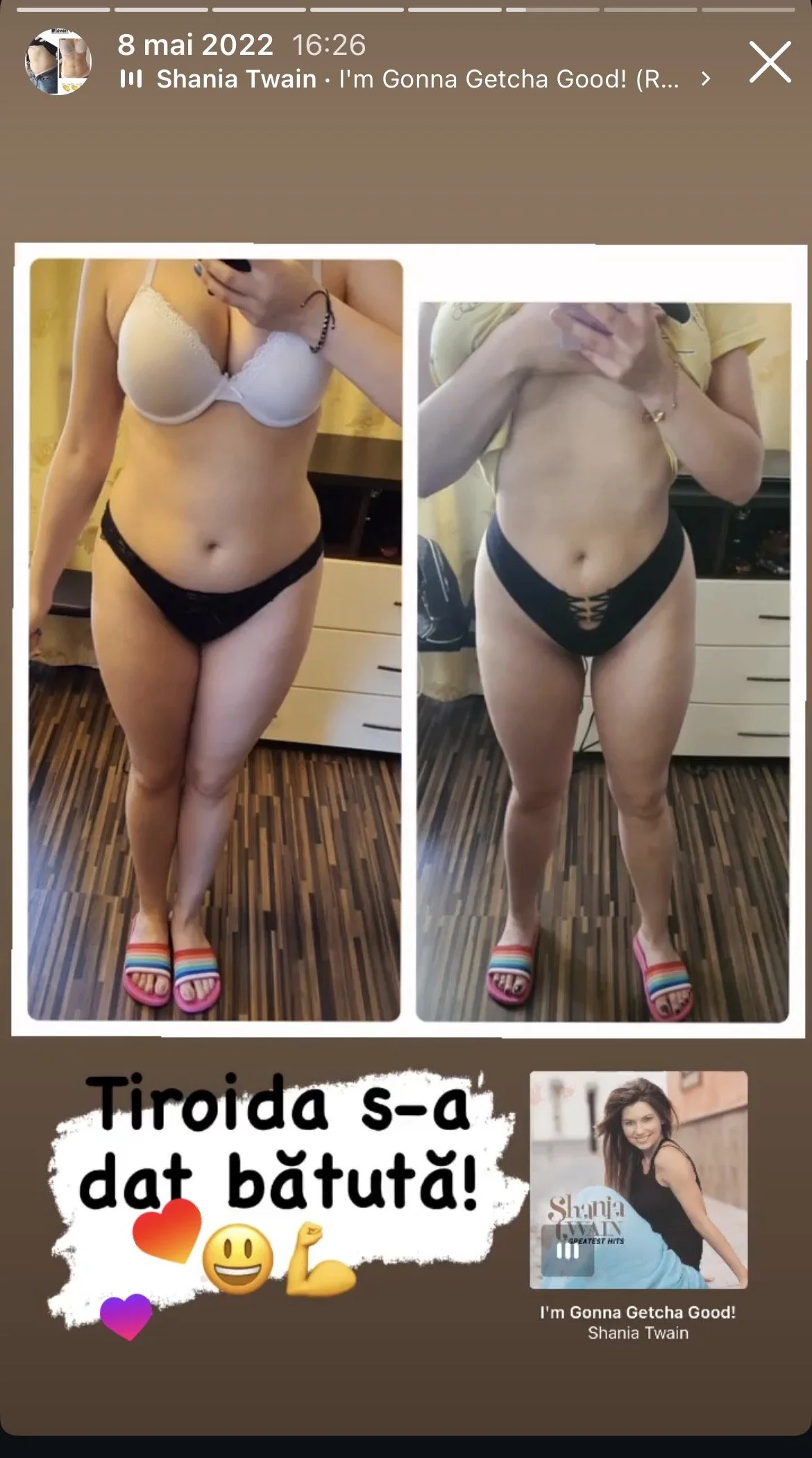 Side-by-side mirror selfies of a woman in a beige bra and black underwear, showing her weight loss progress, with colorful sandals. There is text in Hungarian and emojis, and a small image of a woman with a music player.