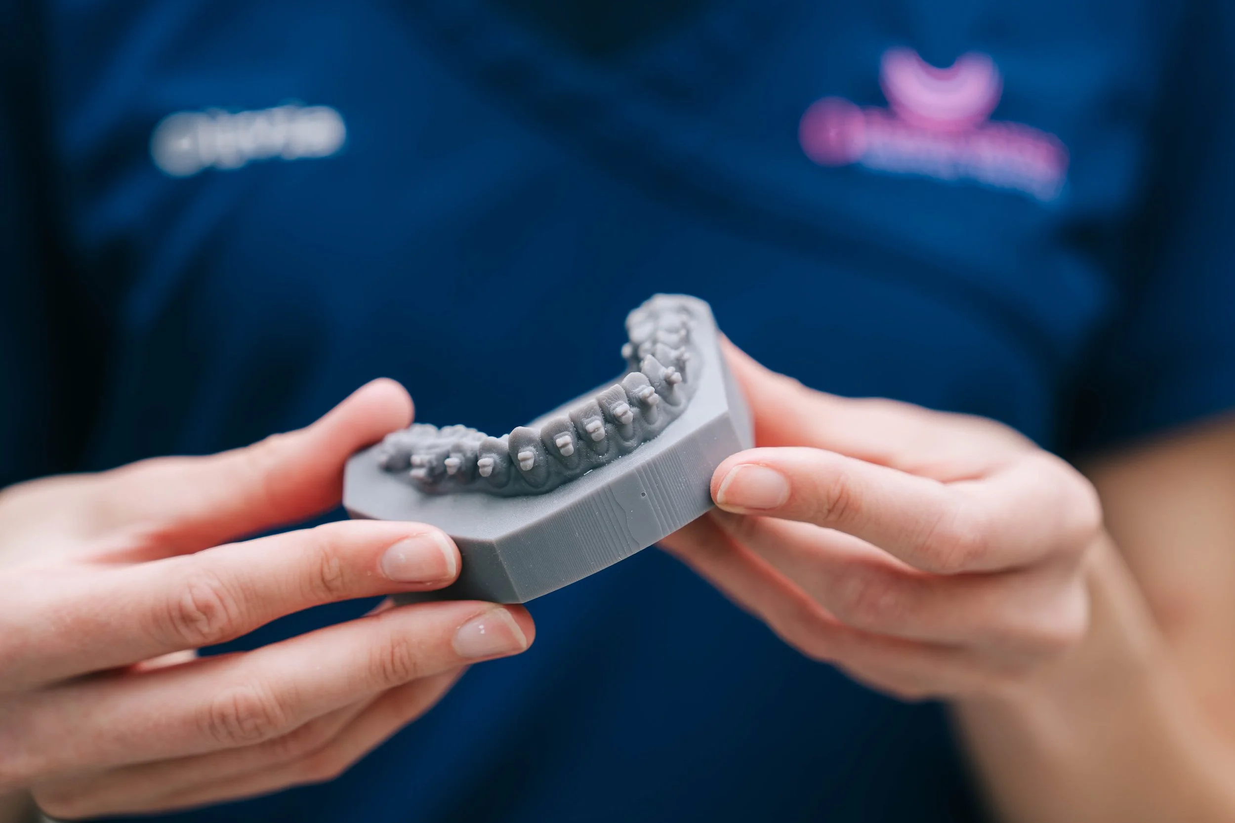 Close-up of hands holding a gray dental mold with detailed teeth impressions.