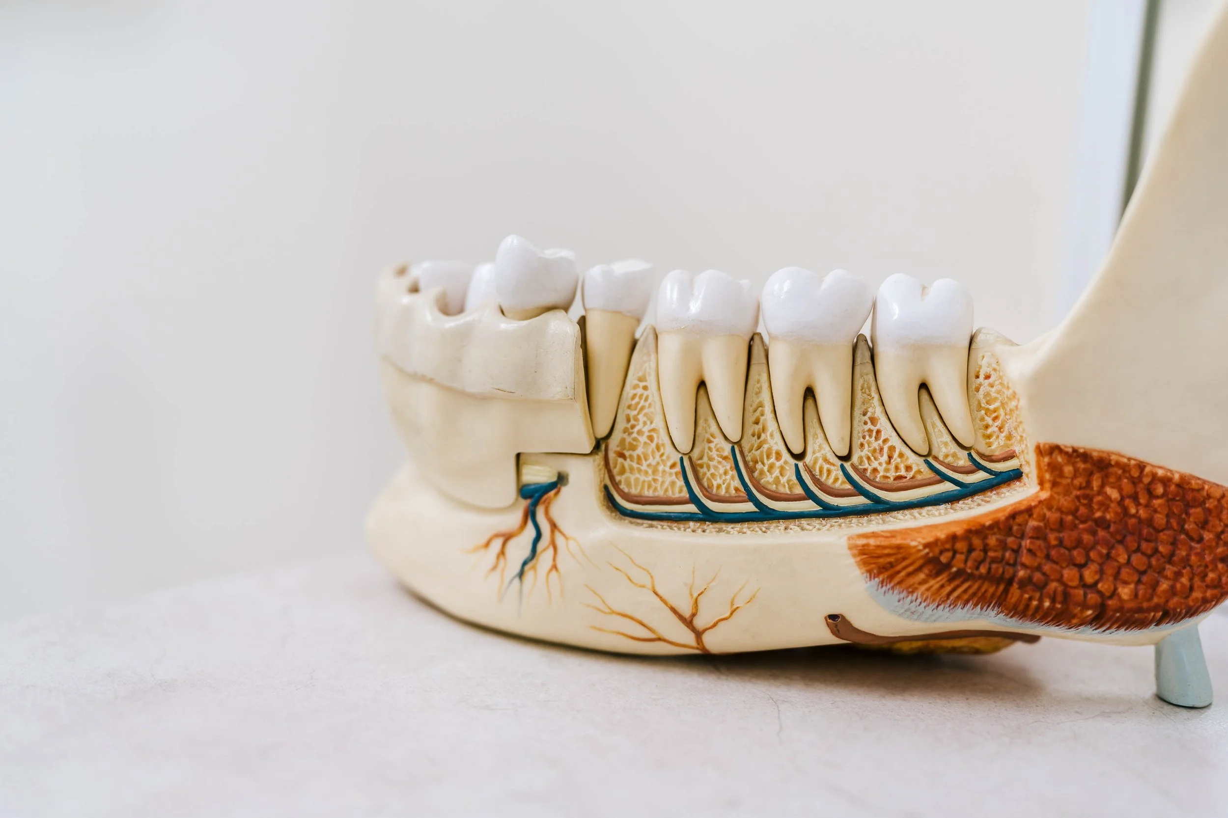 Detailed anatomical model of a human jaw with teeth, jawbone, nerve, and sinus cavity, illustrating dental and sinus anatomy.