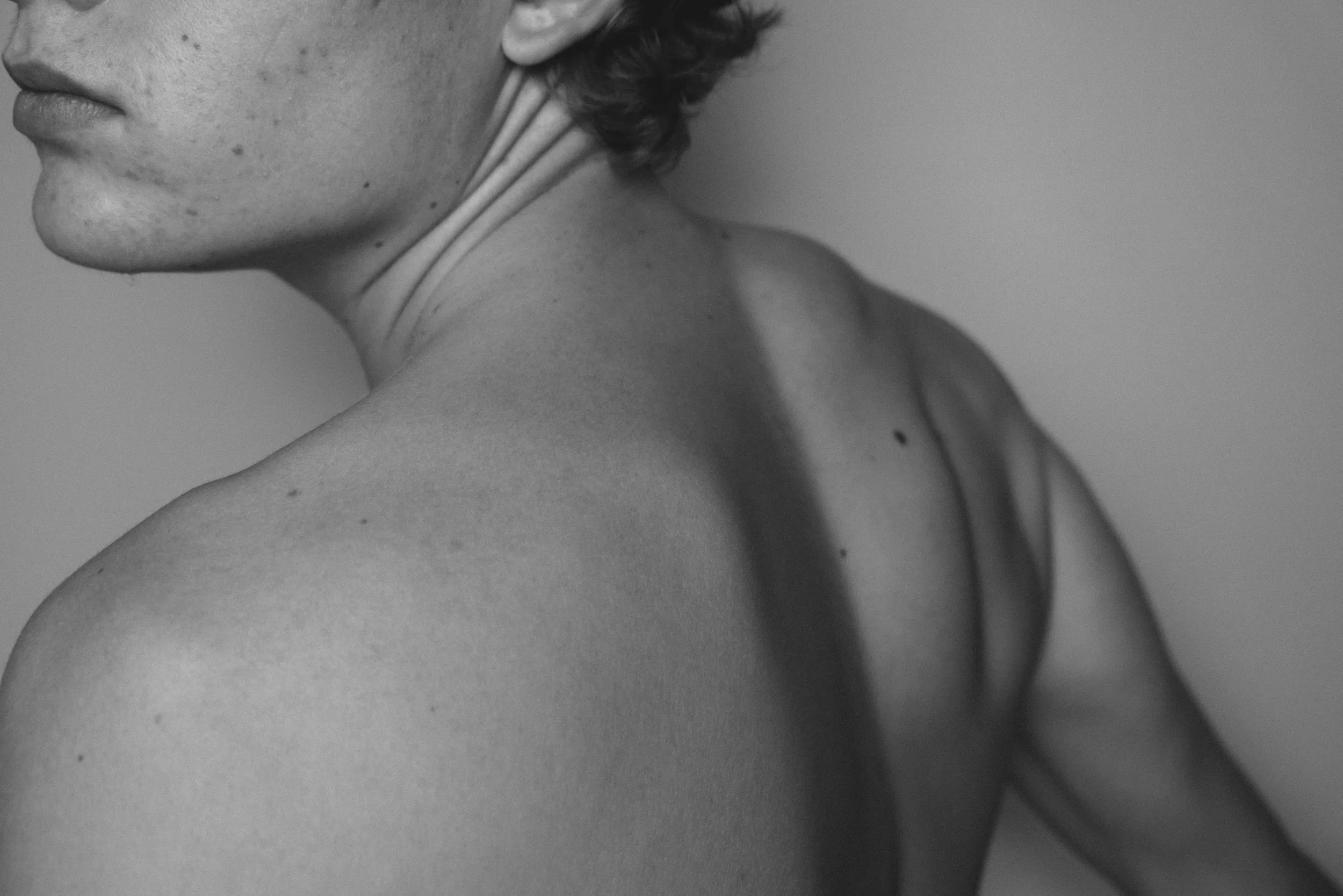 Close-up of a woman's neck and shoulder with small moles, showing some skin folds, in black and white.