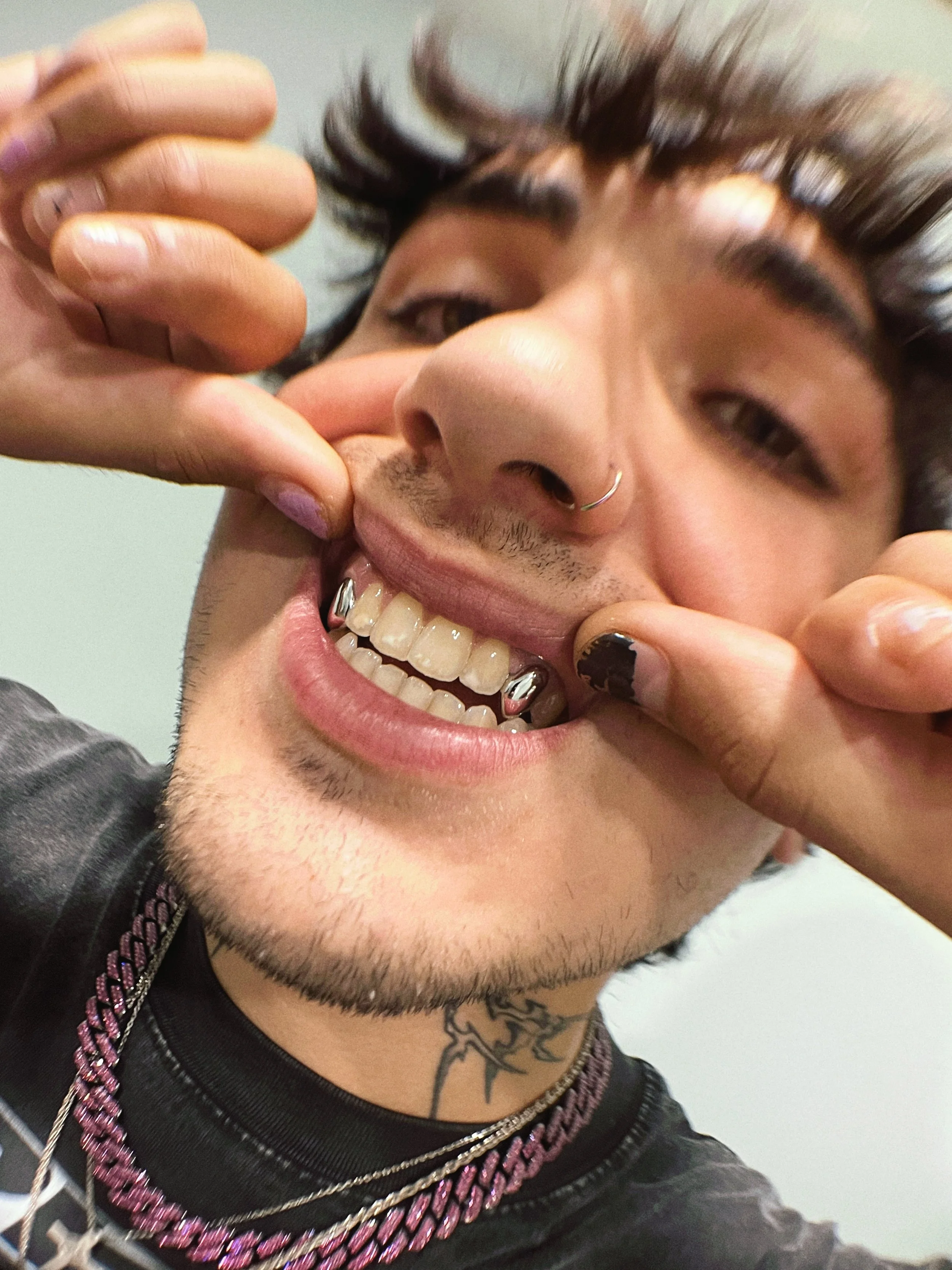 A young man with earrings, rings, and necklaces showing his teeth and pulling his cheeks to reveal his piercings and dental jewelry.