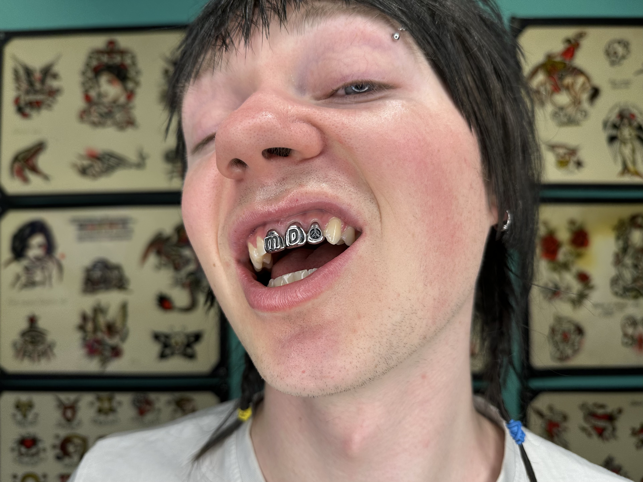 Close-up of a man with black hair and piercings, showing a crooked mouth with metal dental caps spelling 'MDG' and a peace symbol.
