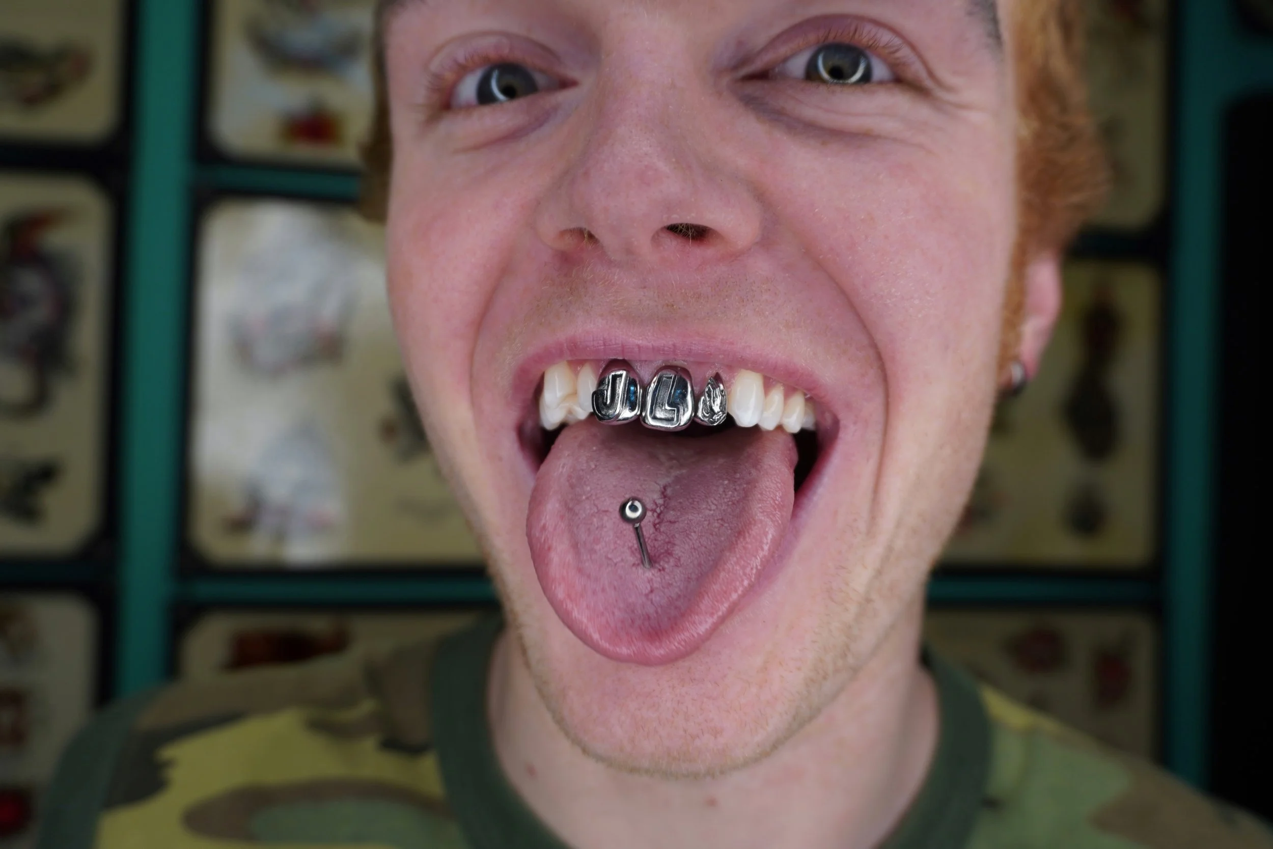 Close-up of a person's face with pink skin, showing their open mouth with silver teeth and tongue piercing, and blue eyes looking at the camera.