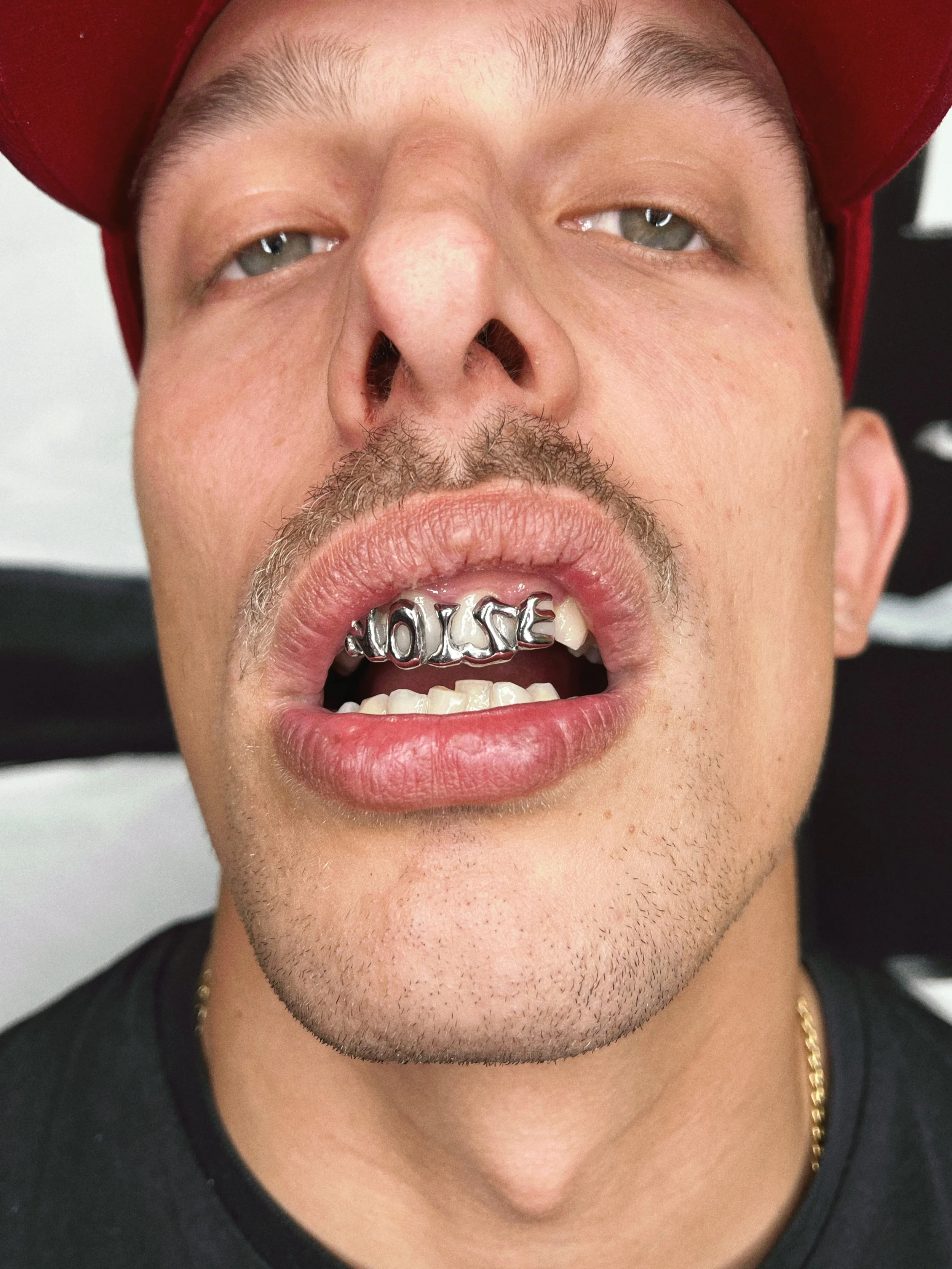 Close-up of a man with a red cap, showing his face and mouth. He has a grill with the word 'NOISE' on his teeth, and is making an expressive face.