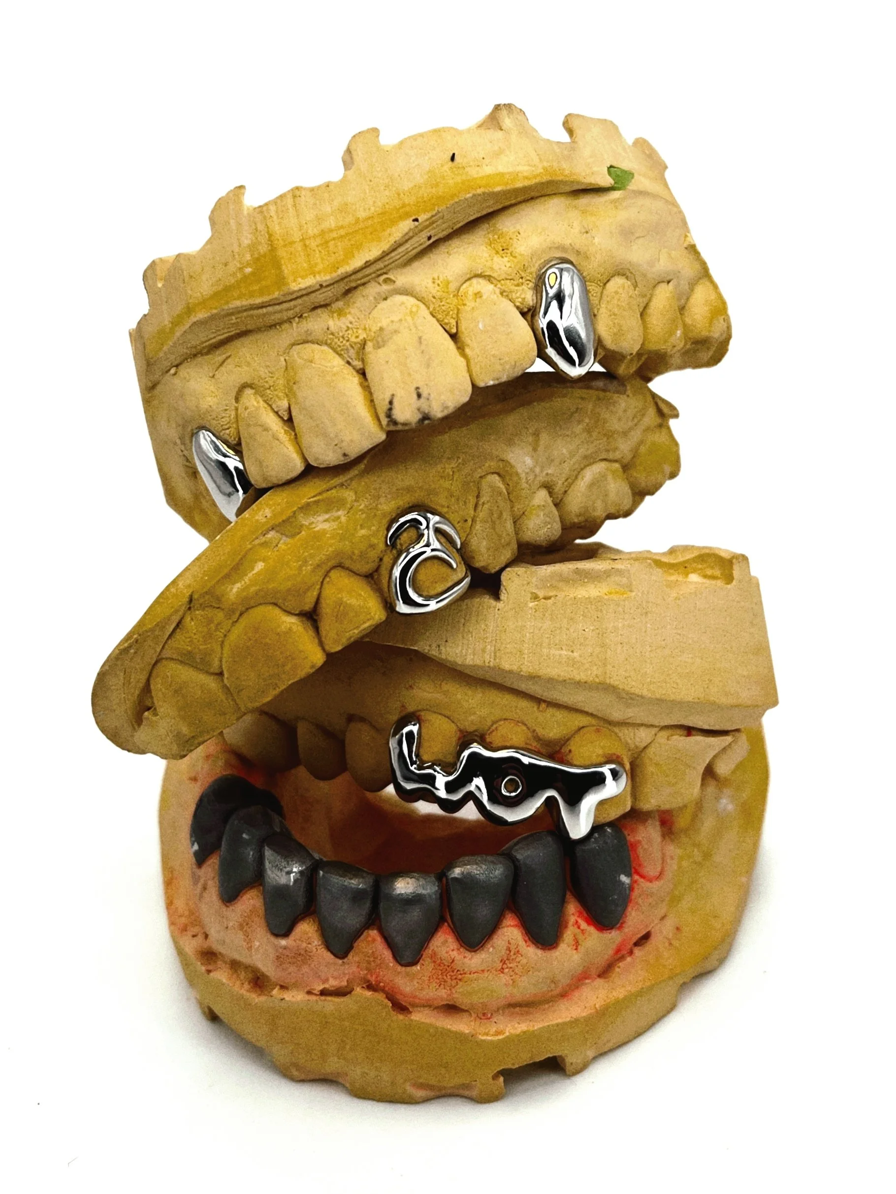 Display of custom-made grillz.