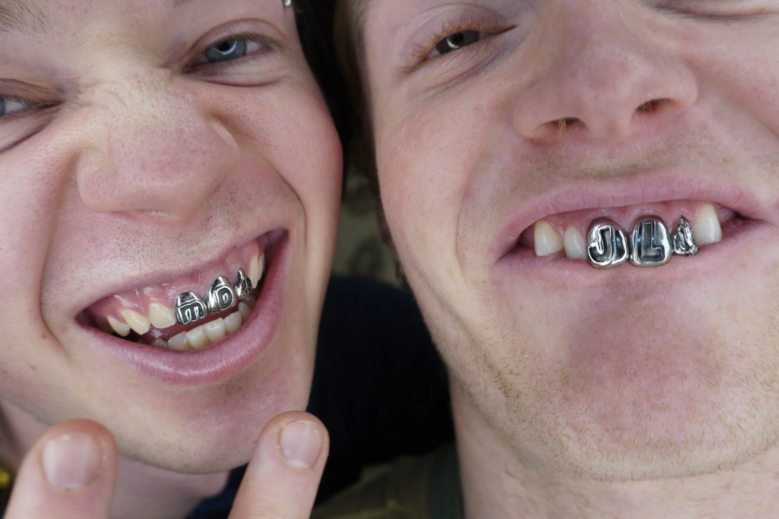 Close-up of two smiling young men showing their teeth with metal letter caps spelling 'MD', 'JD', and 'A' on their front teeth.