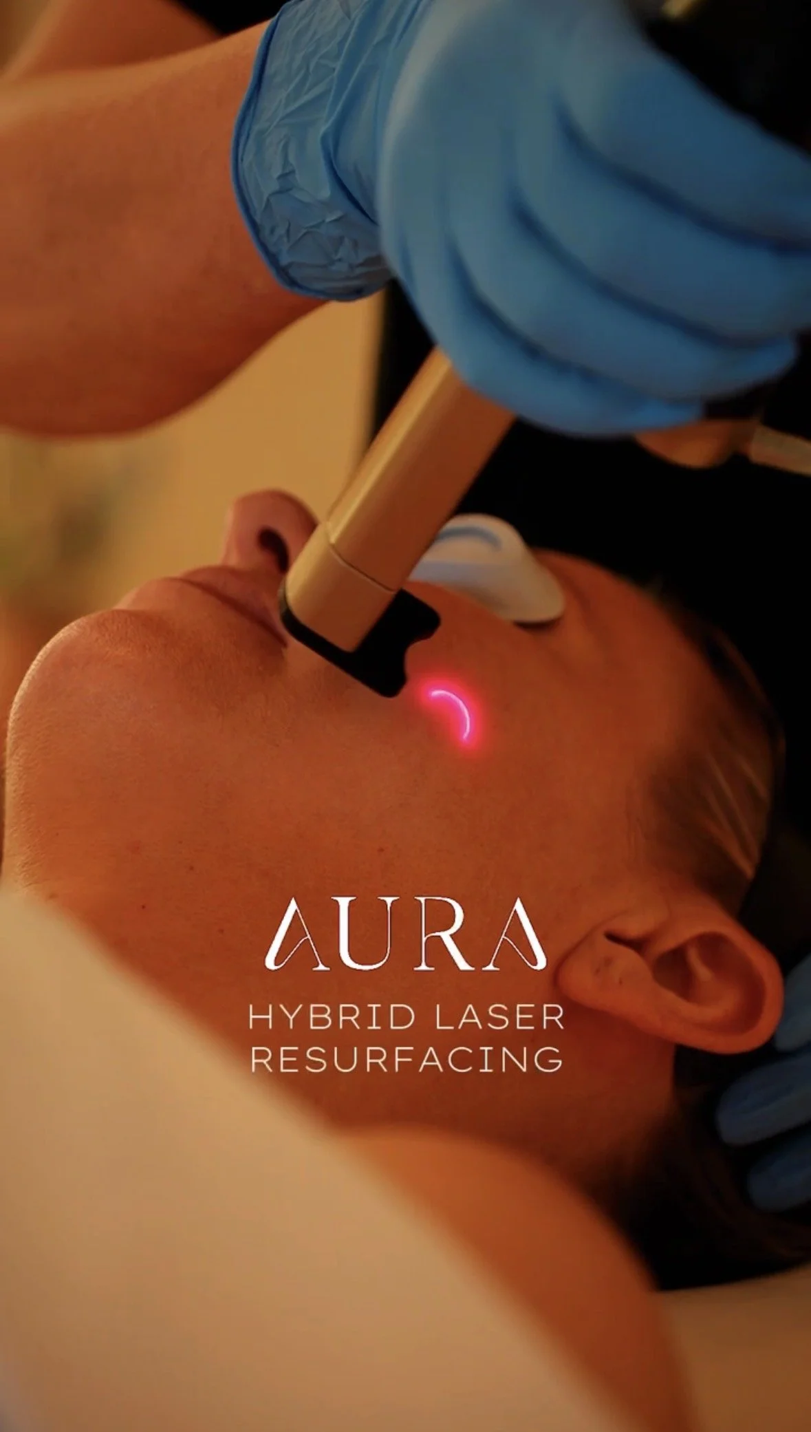 Close-up of laser skin treatments being performed.