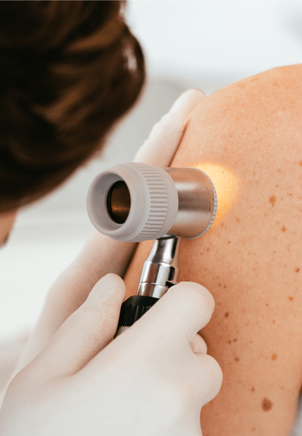 Dermatologe markiert ein Muttermal auf dem Rücken einer Patientin während einer detaillierten Hautuntersuchung in der Klinik.
