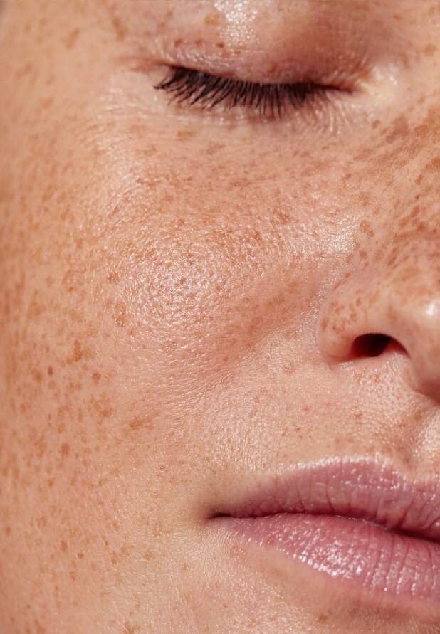 Skinbooster-Behandlung mit feinen Hyaluron-Injektionen für tiefenwirksame Feuchtigkeit und einen strahlenden Glow.