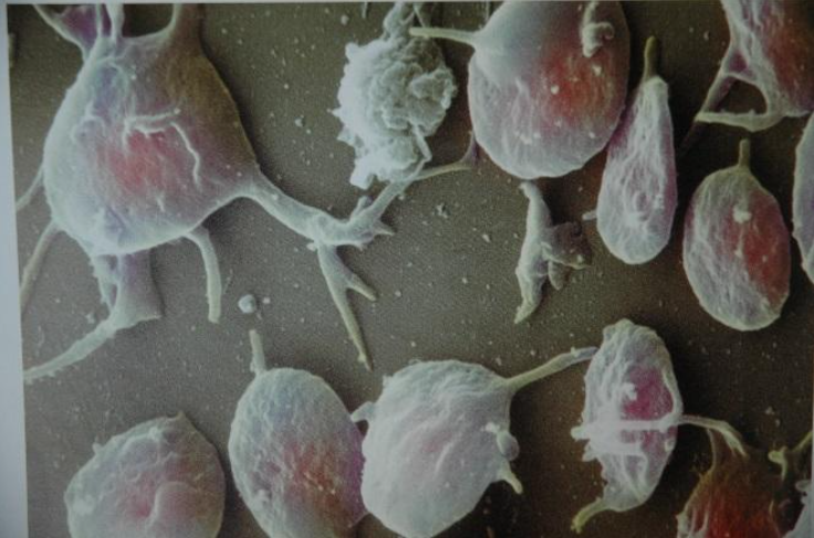 Microscopic view of small, rounded, pinkish biological cells with protrusions.