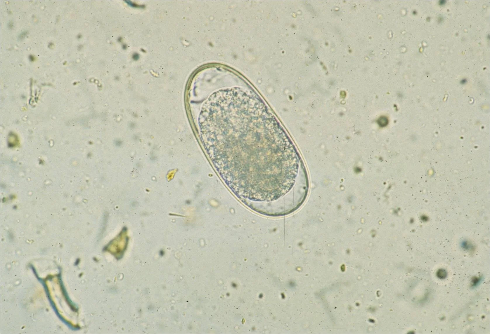 Microscopic view of a single oval-shaped microorganism with internal granules, surrounded by a translucent membrane, against a background of scattered debris and particles.