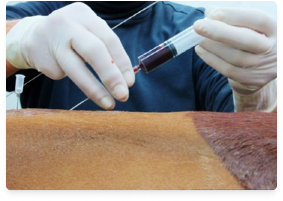 Medical professional drawing blood from patient with a syringe.