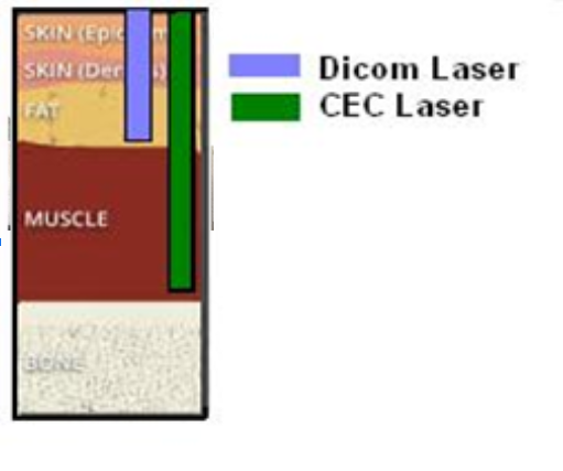 Diagram showing layers of skin, fat, and muscle with labels for Dicom laser in blue and CEC laser in green.