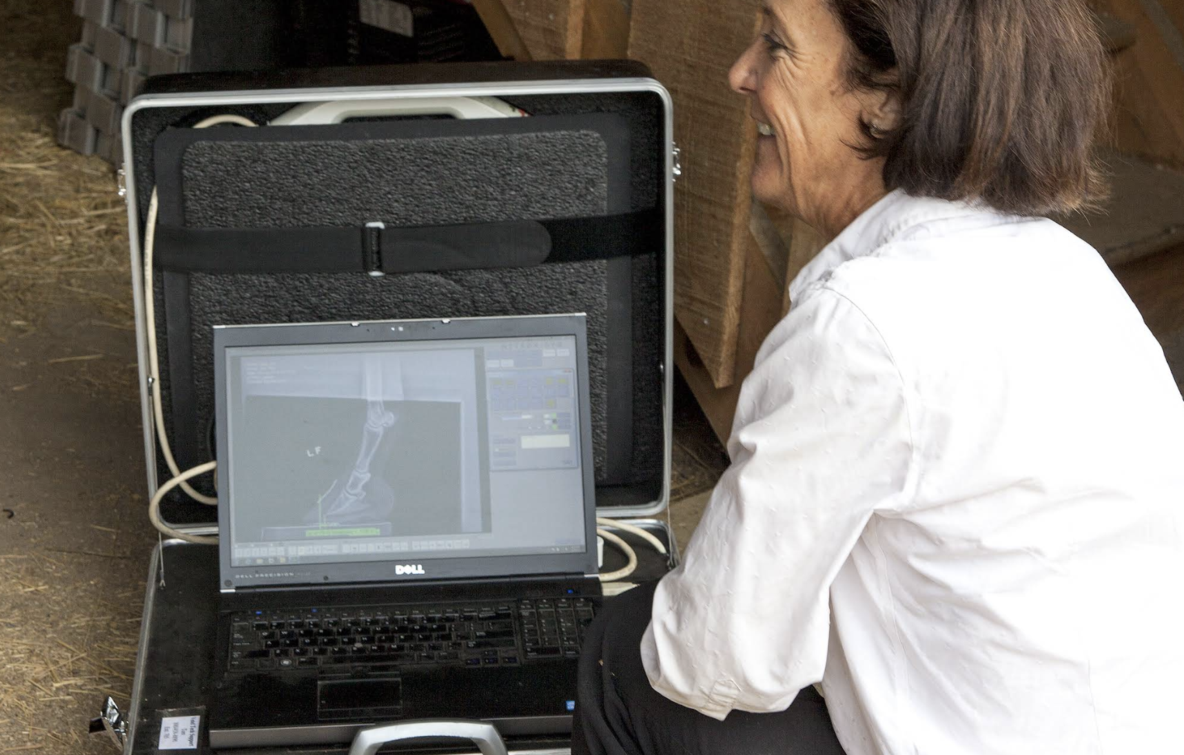 A woman with brown hair, wearing a white shirt, is sitting outdoors and looking at a computer screen displaying medical imaging of a knee joint.