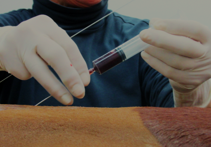 Person wearing gloves and a dark blue shirt handling a test tube with blood for a medical procedure.