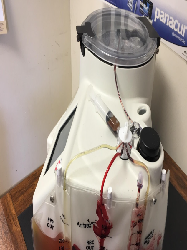 Medical device with tubes and containers connected, used for blood processing or apheresis, placed on a wooden surface.