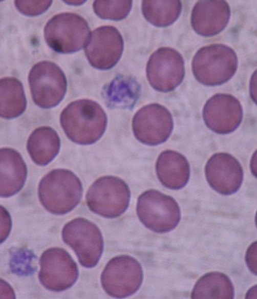 Microscopic view of human blood cells, including numerous red blood cells and a few white blood cells.
