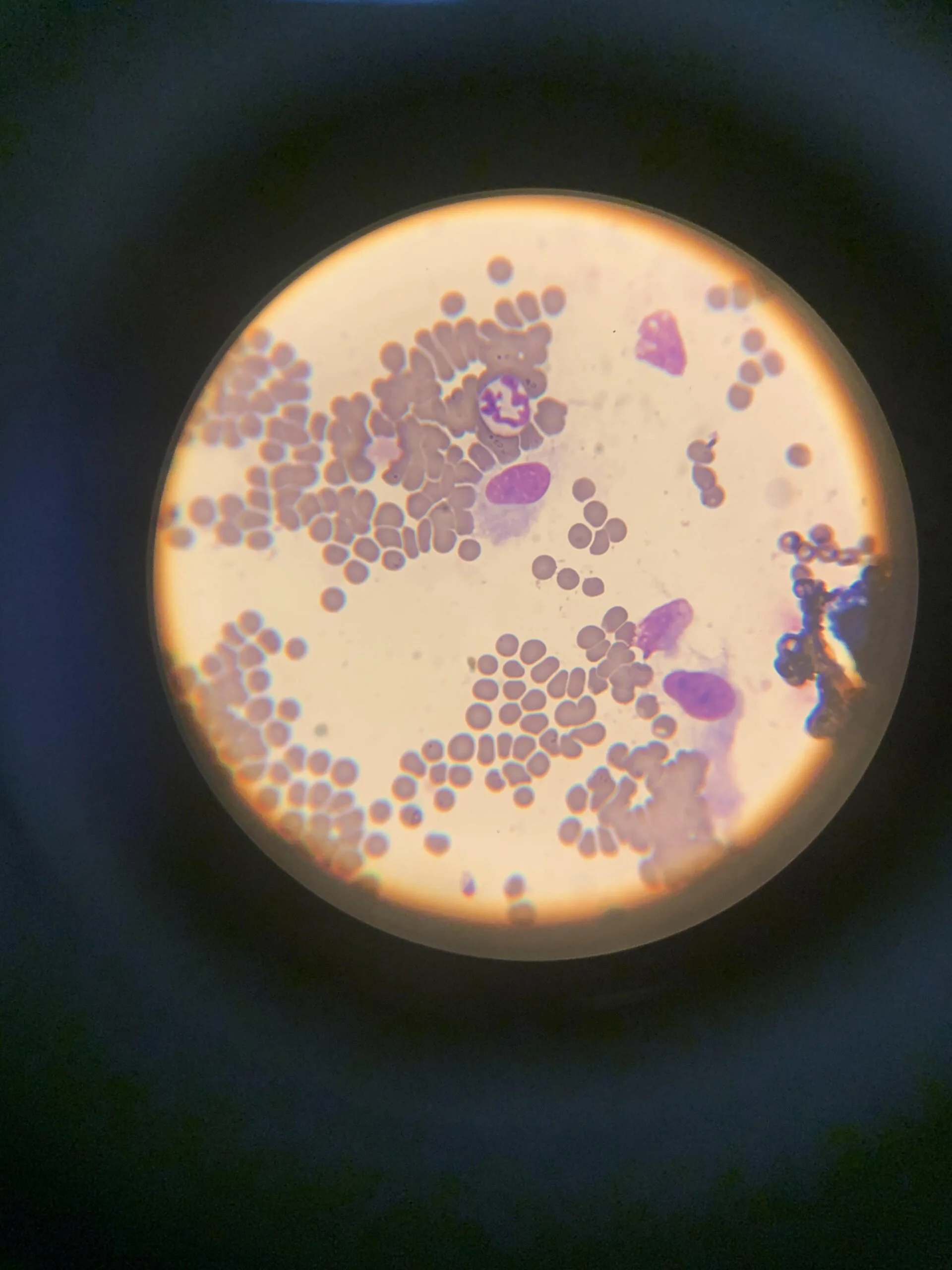 Microscopic view of blood cells, including various red blood cells and some that appear to be white blood cells or platelets, viewed through a microscope.