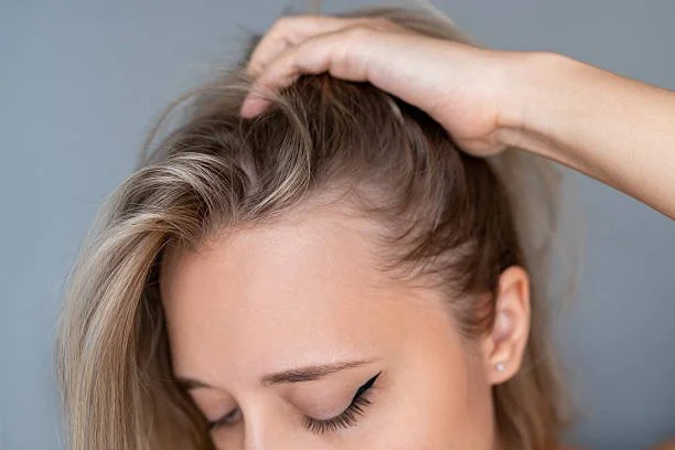 Hair Loss Products: What Actually Works (And What Could Be Damaging Your Hair)