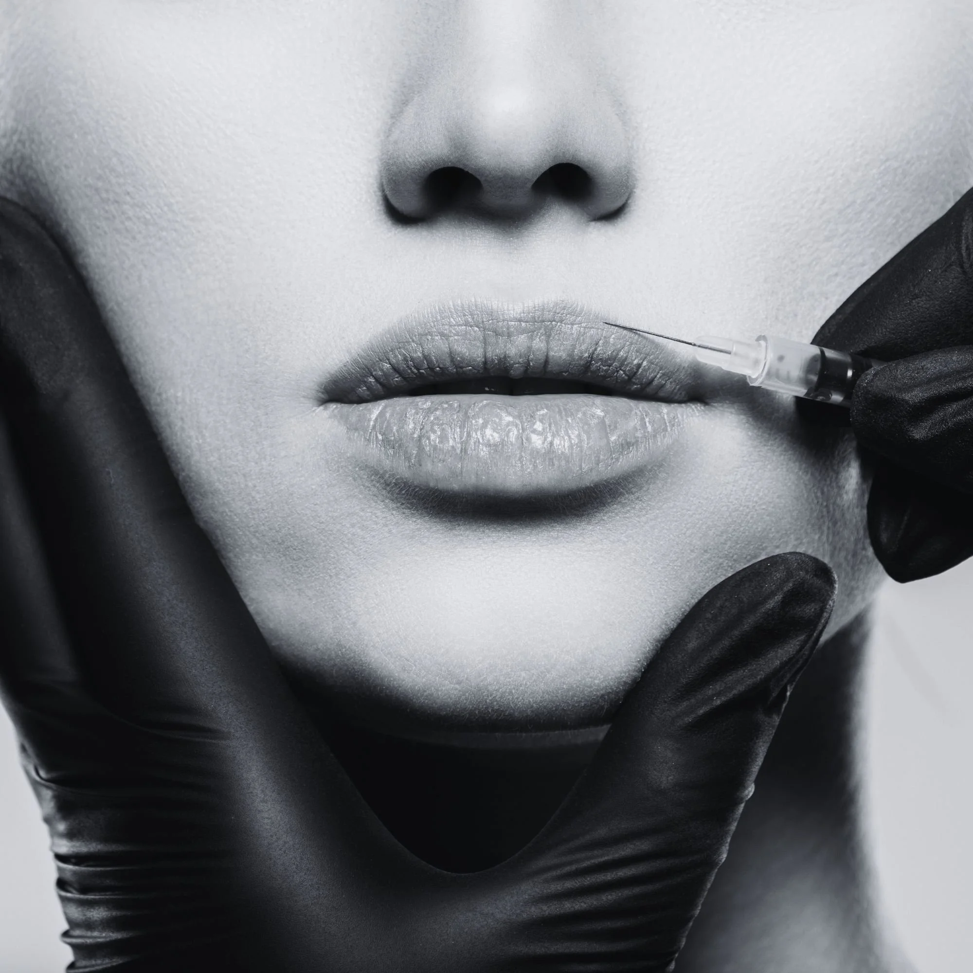 Close-up of lips representing injectable treatments like fillers and wrinkle relaxers
