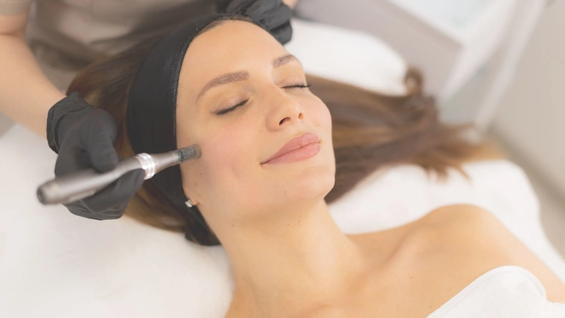 Skinstylus® Microneedling Pre- and Post- Procedure Instructions