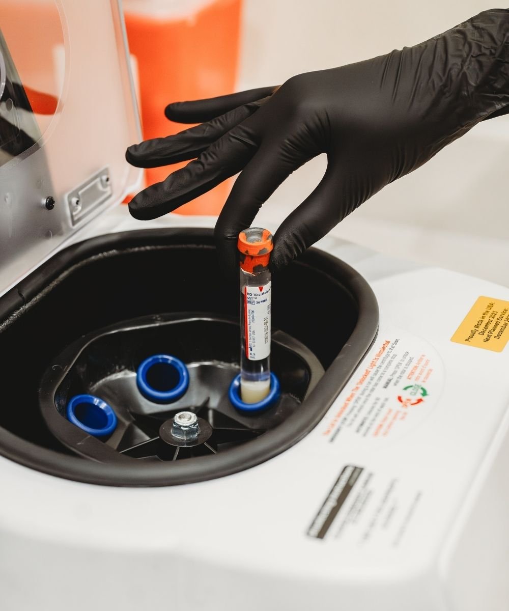PRF Biofiller Pre- and Post- Procedure Instructions