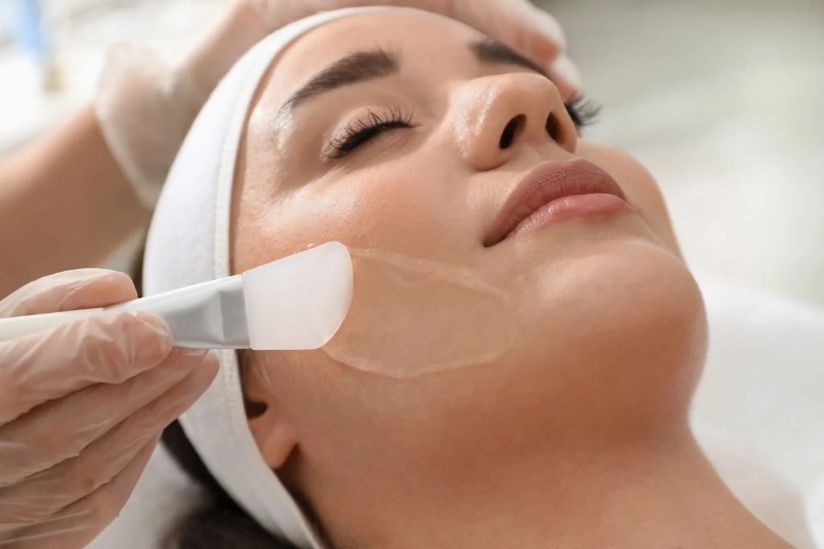 Woman photographed during a chemical peel treatment.