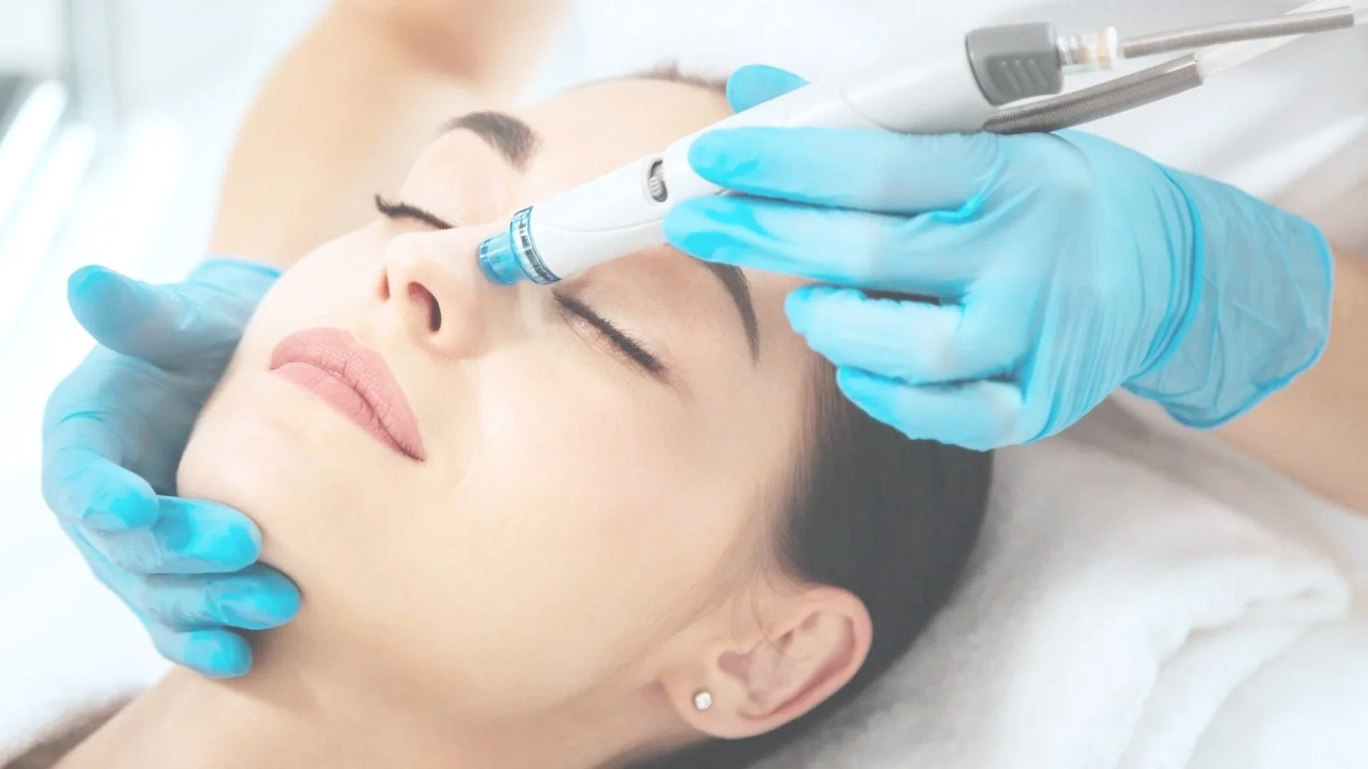 A woman receiving a cosmetic facial treatment with a device, while lying down with her eyes closed, wearing blue gloves.