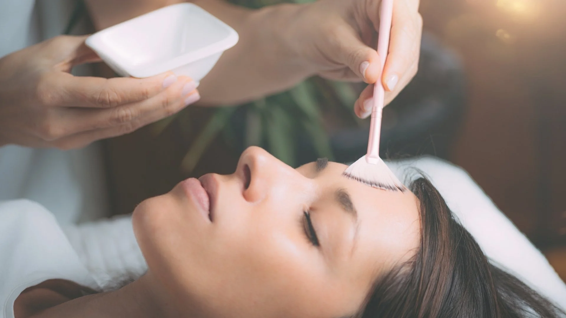 How Chemical Peels Can Improve the Appearance of Acne Scars